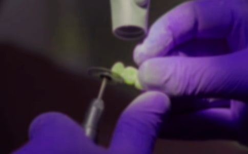 拔牙记叙事作文250字